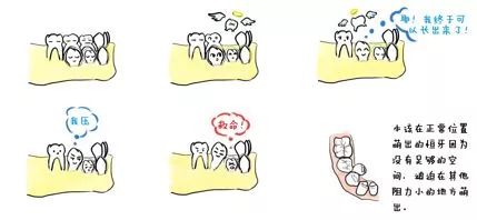 如何让小孩从小拥有一口好牙齿,牙医教小朋友如何保护牙齿