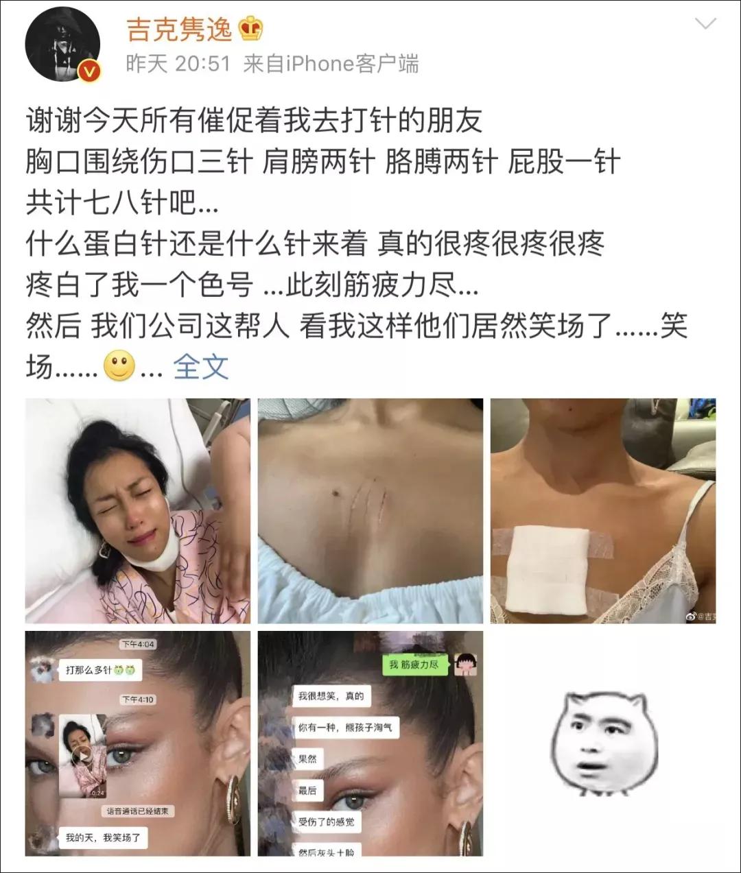 猫抓伤的地方痒,我被猫抓伤了怎么办