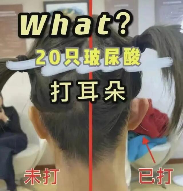 私密整容紧缩手术在中国合法吗,整容医院做私密收紧术要住院吗