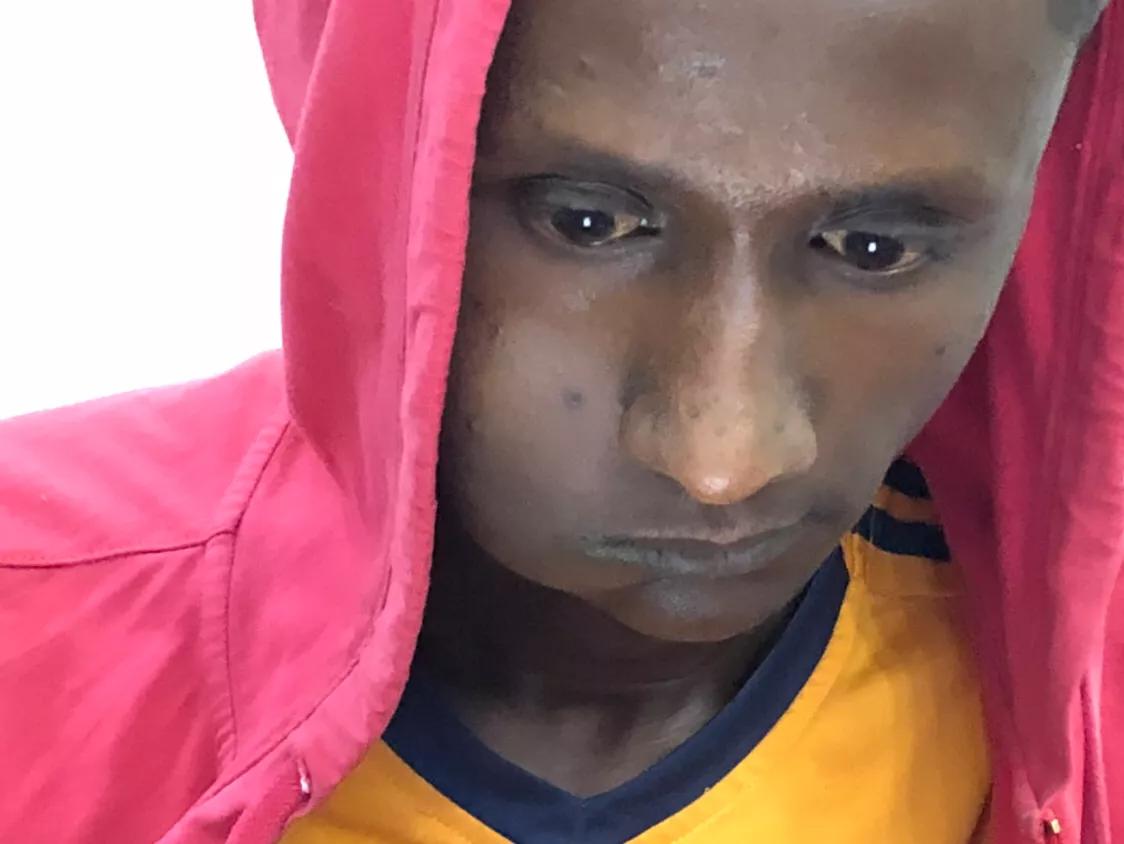 也门人腮帮子鼓起,也门人为什么嘴巴一边鼓起