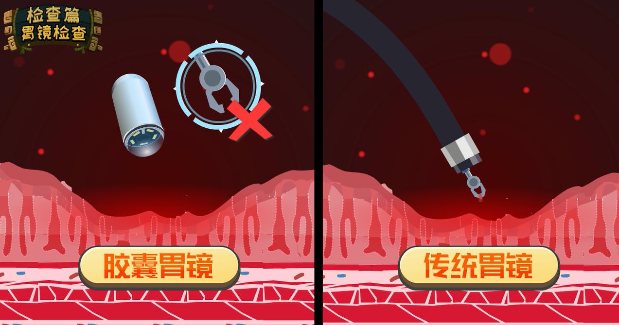 无痛胃镜真的无痛嘛,无痛超声胃镜和无痛ct