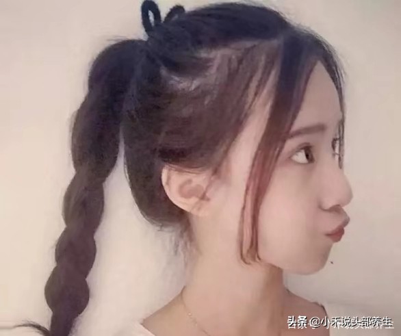 怎样能使头发没头屑,绷带太紧特别痒还有头屑怎么办