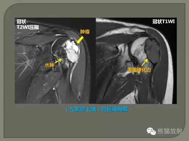 如何简单理解、认识MRI图像