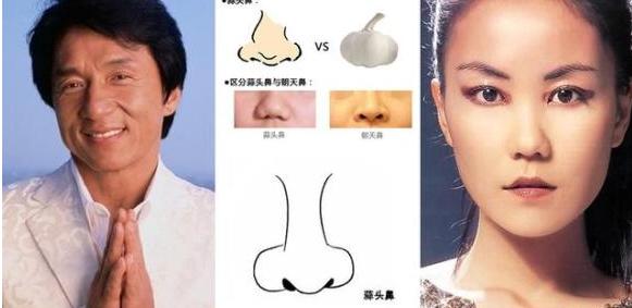 塌鼻子蒜头鼻瘦下来能好看吗,塌鼻梁蒜头鼻侧脸为什么会很丑