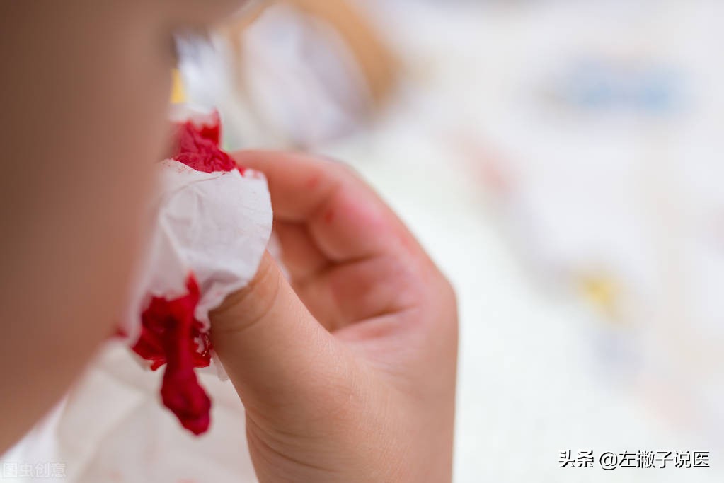 小孩流鼻血查血能查出来吗,孩子流鼻血医院检查正常怎么办