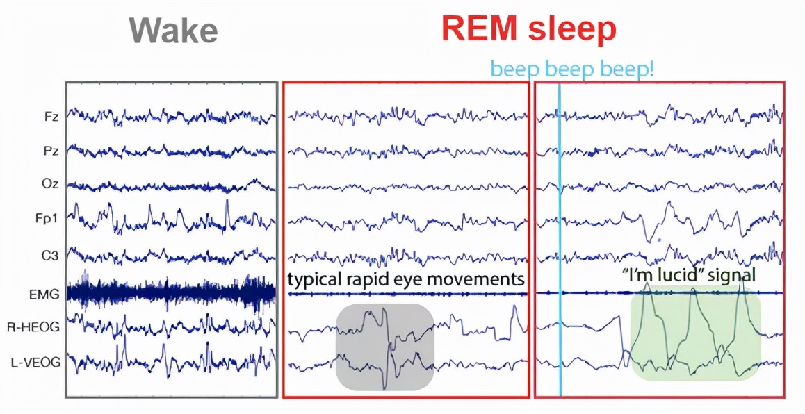 呃！人睡着后，会变冷血动物？睡觉会让大脑缩小20%？