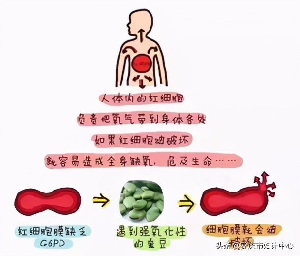 蚕豆病g6pd缺乏是什么意思,认识蚕豆病