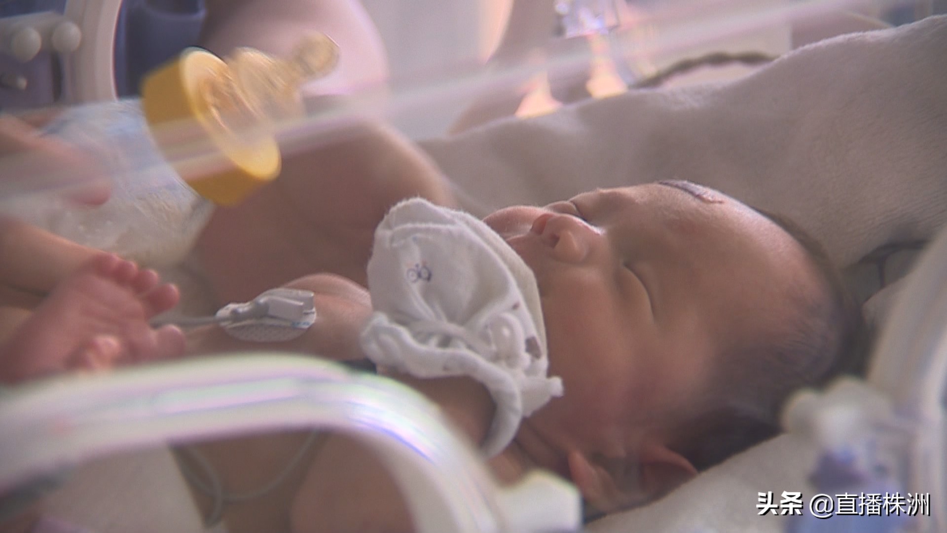 早产儿呼吸困难有危险吗,早产儿呼吸窘迫综合征要紧吗