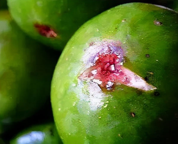 肛裂要引起足够的重视,肛裂的预防你了解哪些好的措施呢