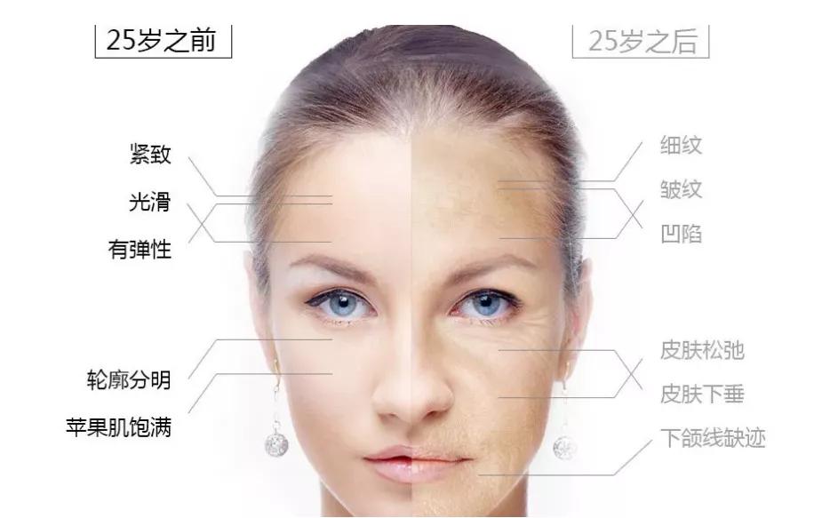 25岁好多细纹,25岁就有皱纹了怎么办