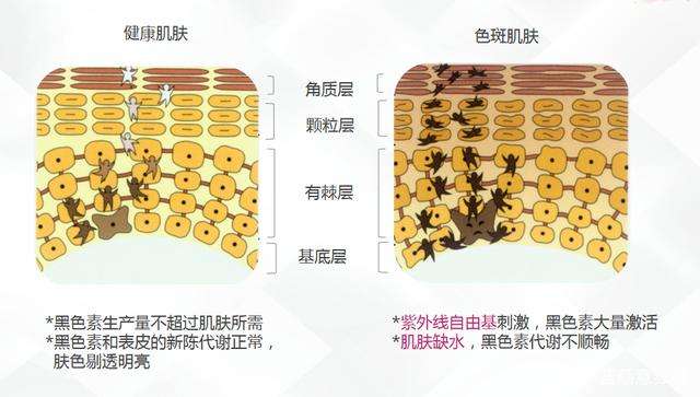 祛斑的误区，你遇到过几个？