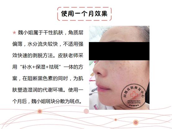 孕妇长斑修护产品,孕妇长斑怎么办用什么可以祛斑