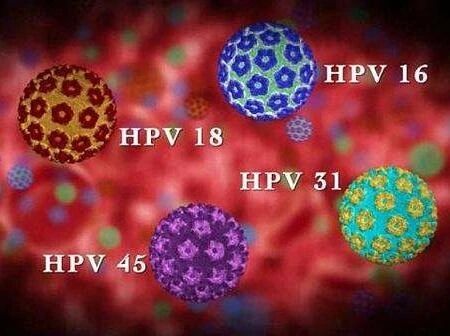 辣眼睛！若私密部位出现浅红色赘生物赶紧治，它会一直传染不停歇