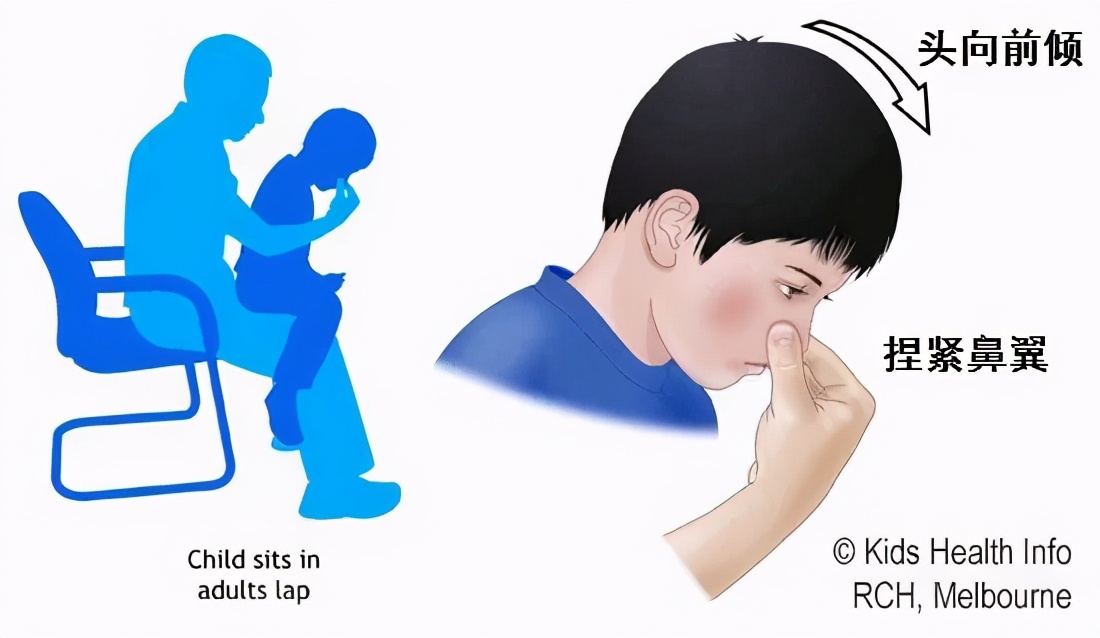 宝宝鼻子流鼻涕擦破了老是不好,宝宝鼻子堵流鼻血