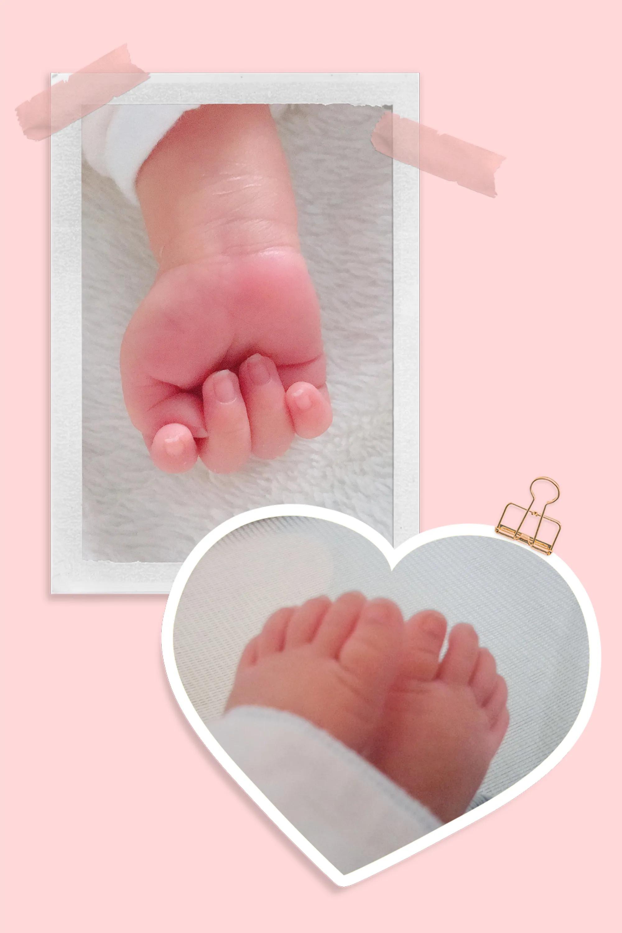 我的顺产日记二胎,顺产宫缩的经历