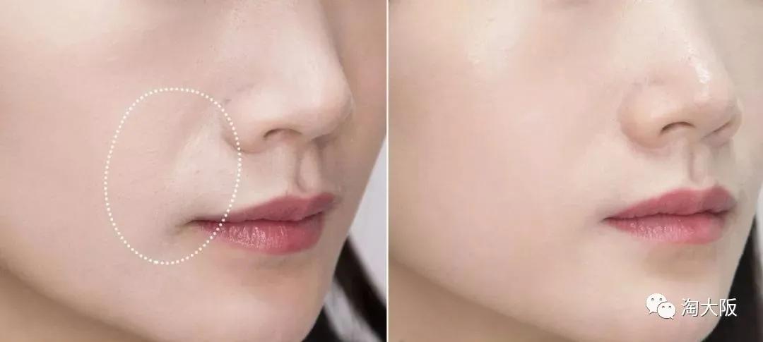 无刺激清爽保湿效果好的面霜,百优面霜清爽型