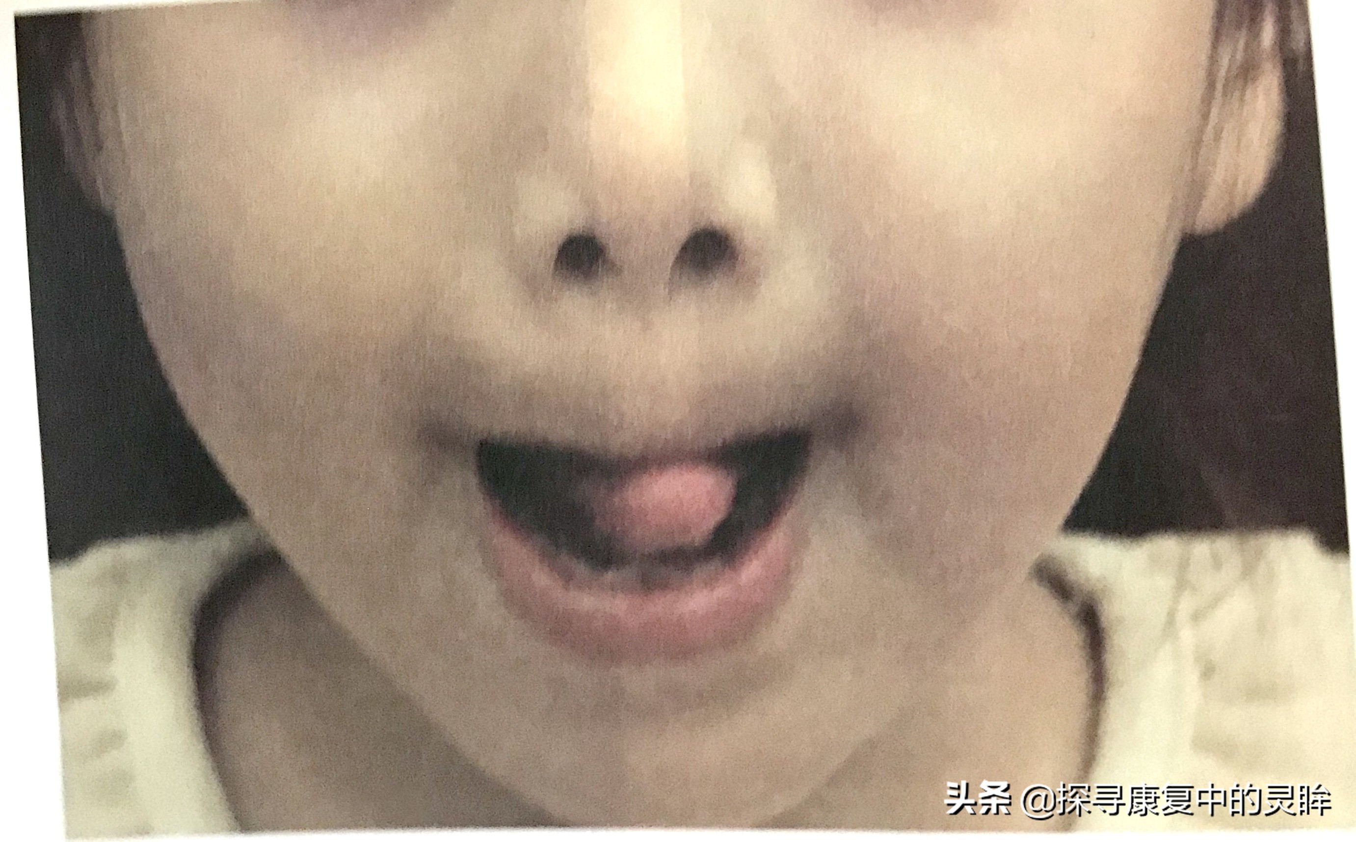 五种口部运动:灵活孩子的樱桃小嘴,让他们说话更清晰(超简单)