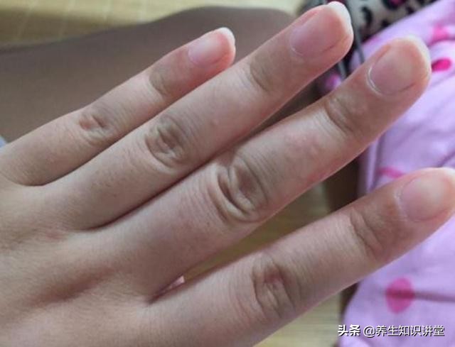 手上长密密麻麻水泡很痒涂什么药,手上长小水泡很痒可以把泡刺破吗