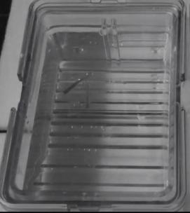 对生活提不起兴趣和体质有关系吗,对生活缺乏兴趣