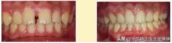 诺尔口腔牙齿矫正怎么样,淄博诺尔漫口腔