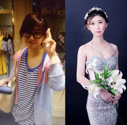 生育损害,生育后做哪些产后修复