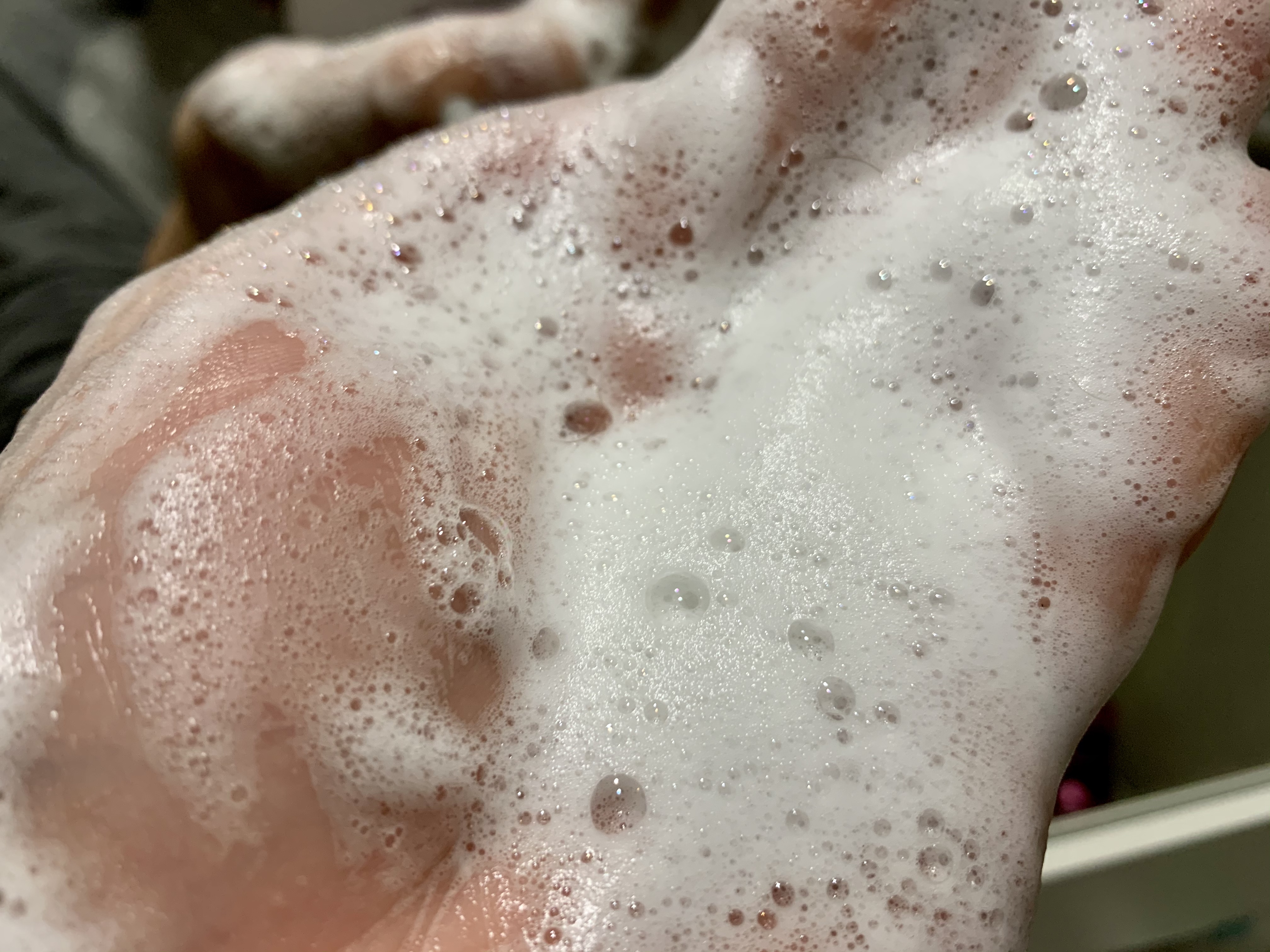 生姜擦头皮管用吗防脱发,生姜擦头皮可以生发防脱发吗