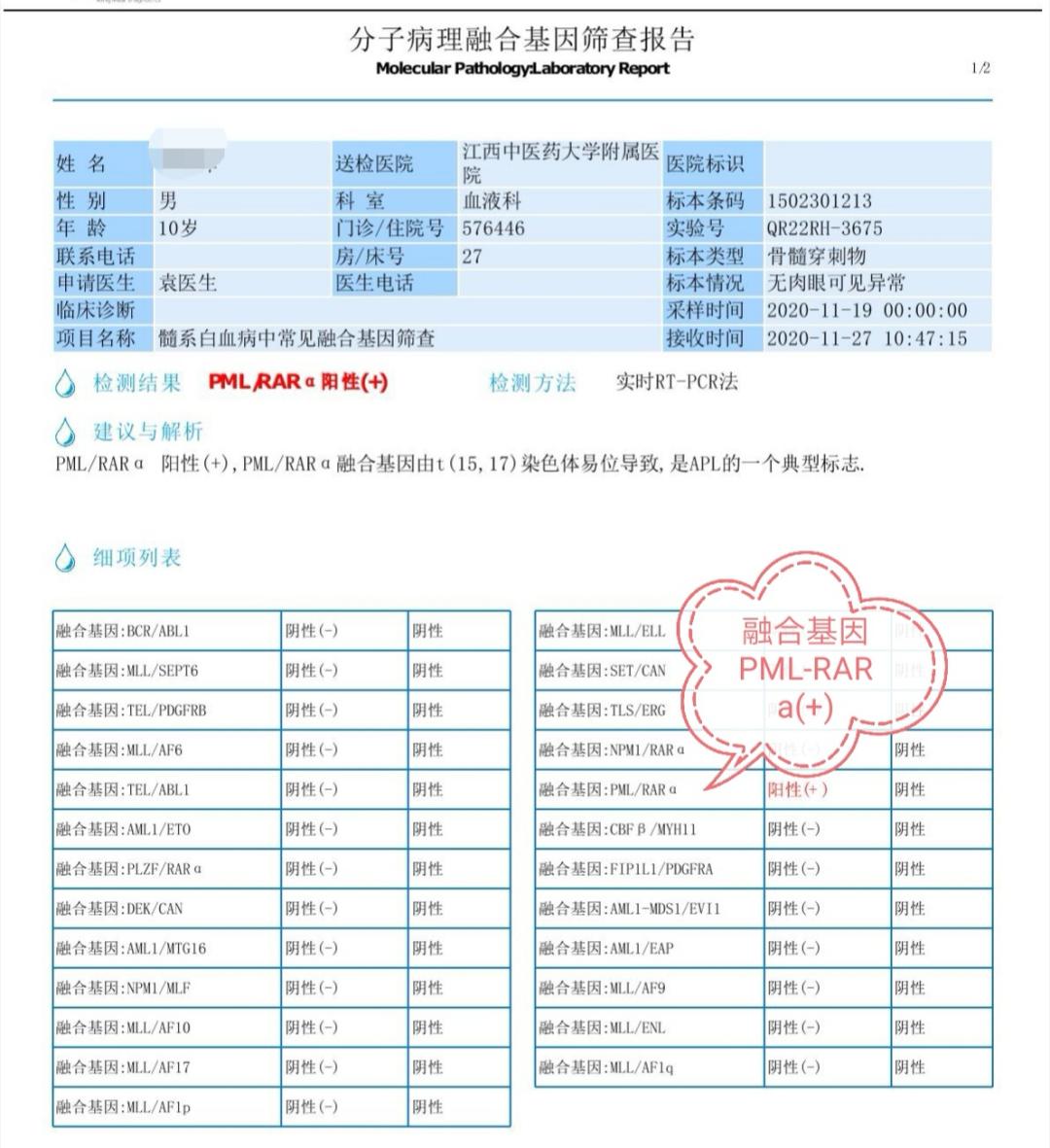 60岁以上急性髓系白血病存活几率,急性髓系m2b白血病治愈几率多大