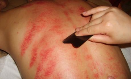 刮痧特别疼怎么回事,刮痧的痛一般人能受得了吗