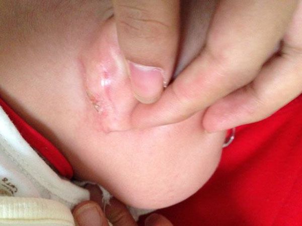 宝宝频繁清洗的危害,宝宝不能过度清洗的地方