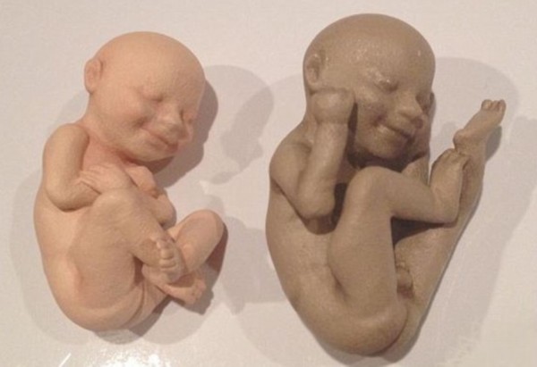 怀孕流产后四个月又怀孕,怀孕后流产了一年多了怀不上为啥