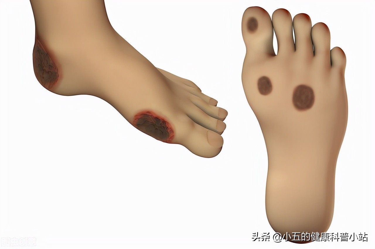 丹参滴丸治心血管病吗,丹参滴丸治心血管堵塞吗