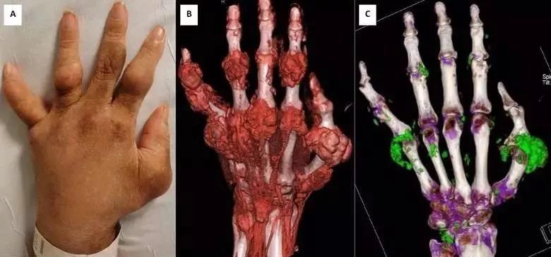 为什么霸王龙是吃肉的而不吃草的,霸王龙有什么病