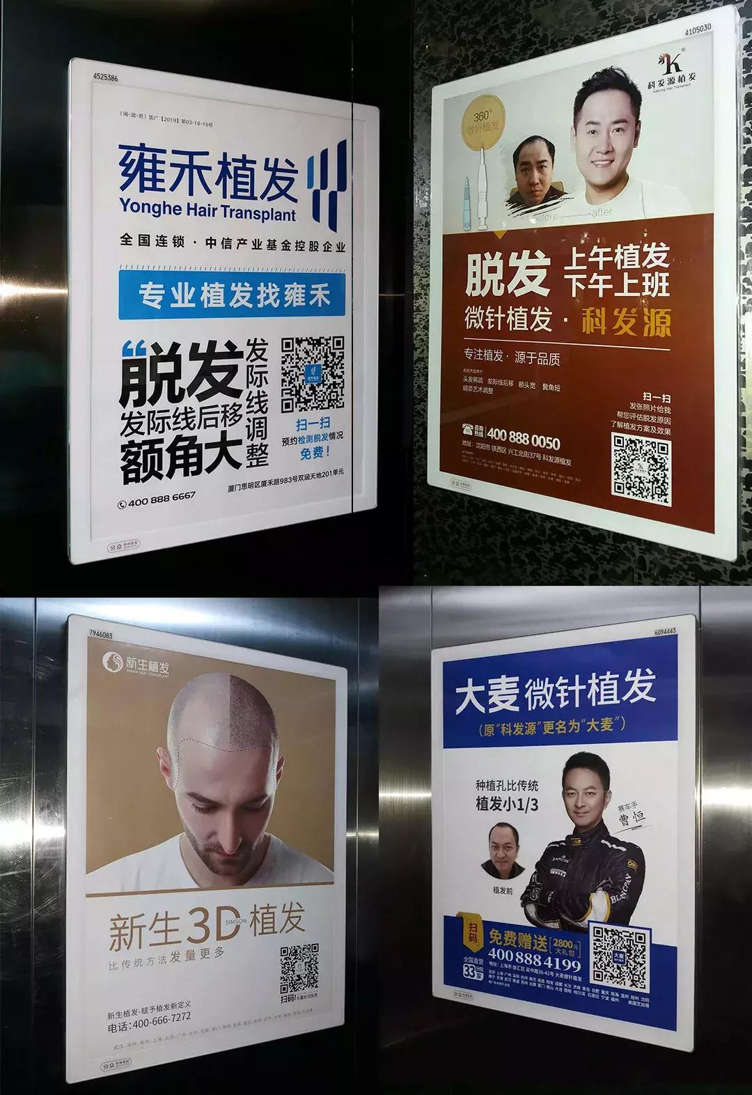 脱发的人没人在乎,没有脱发的人是什么心理