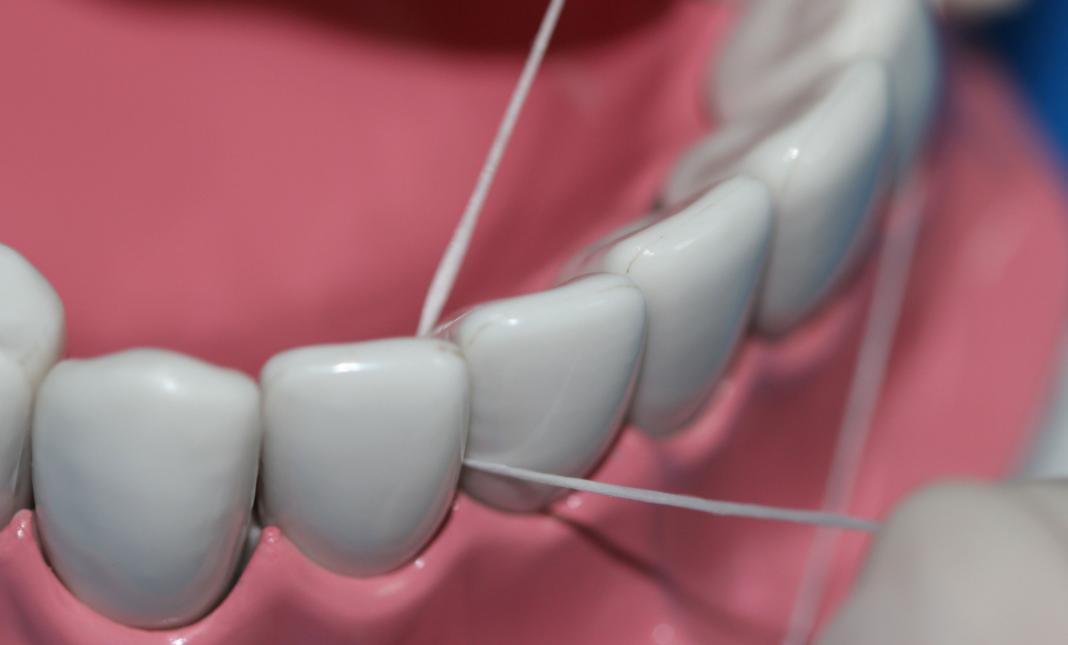 为什么用牙线时牙缝勾住牙线,细牙缝用圆牙线还是扁牙线