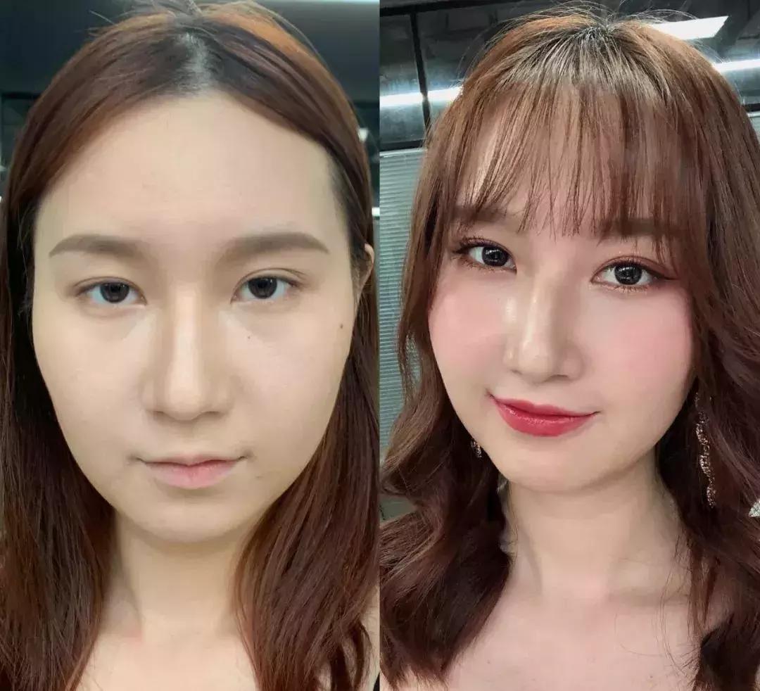 去割双眼皮,去韩国割双眼皮科学不