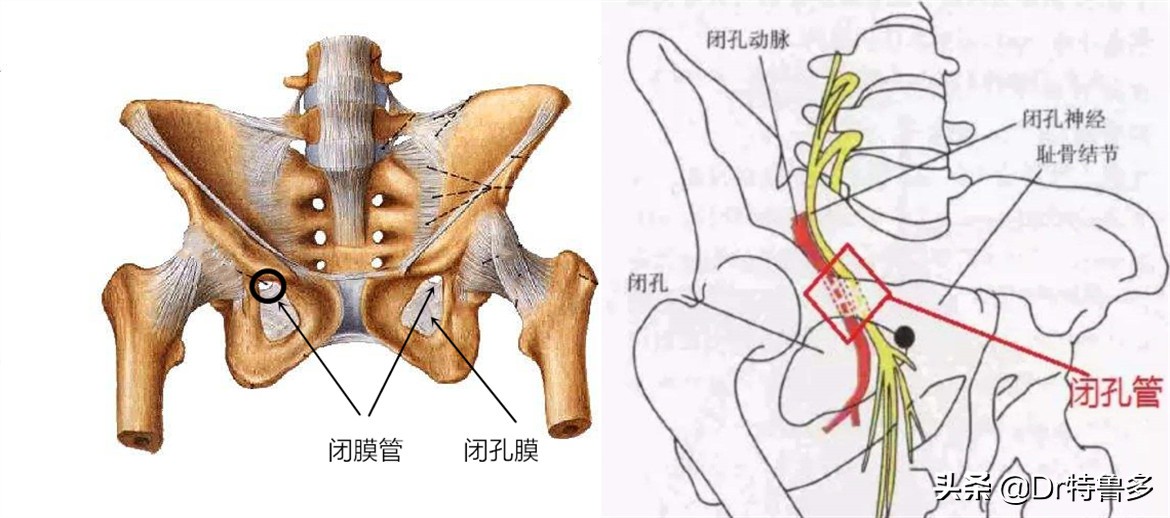 大腿内侧痛,胯也痛...有根神经被卡住了
