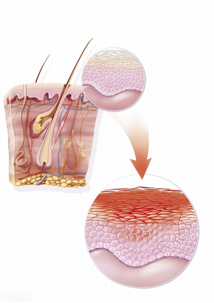 湿疹总是不好吃什么药,湿疹总是不好也不是过敏怎么回事