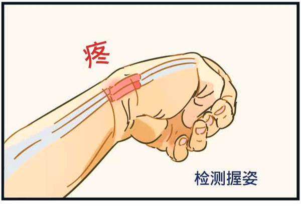 长期伏案人员，谨防腱鞘炎