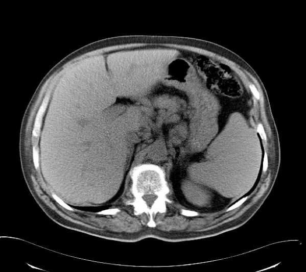 ct图像解析大全,ct图像与实物大小对比