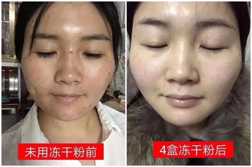 口罩大了戴口罩的小技巧,口罩继续戴防护不松懈