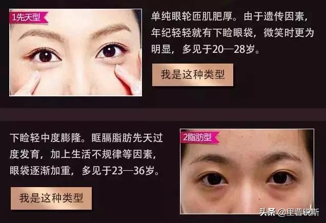 祖传药膏去除眼袋,祖传治疗眼袋