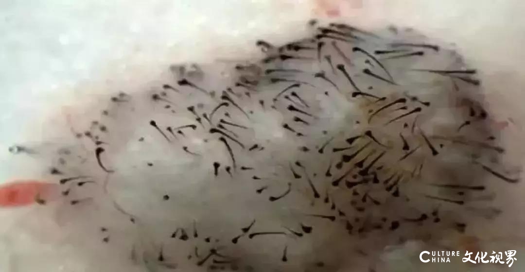 干细胞疗法神奇的干细胞再生医学,干细胞能使神经再生吗