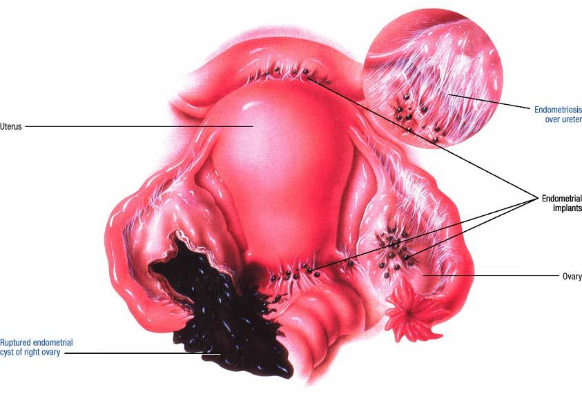 女性下腹痛的原因有哪些,女性下腹部疼痛一般是怎么回事