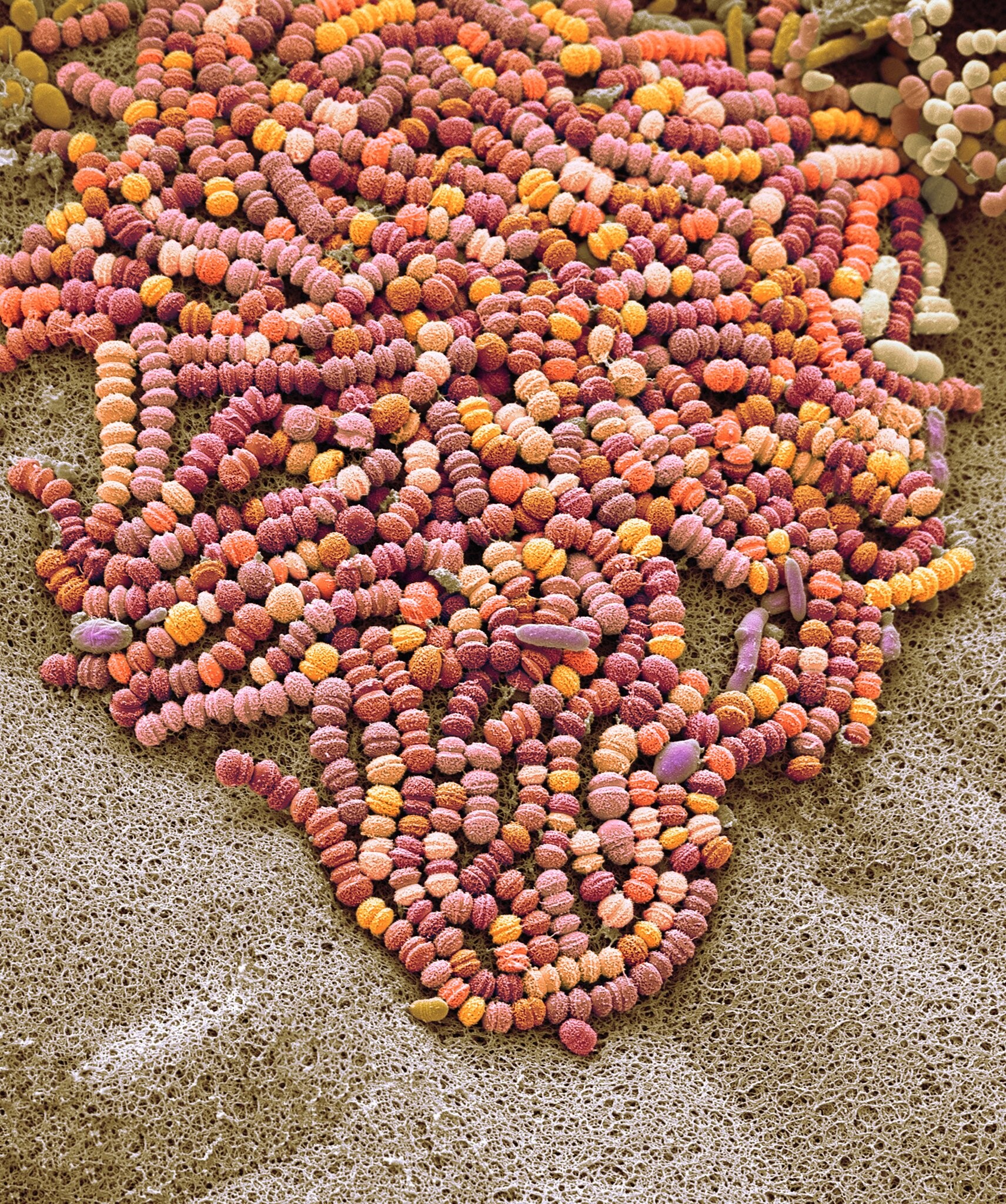 肠道菌群移植可以治疗自闭症吗,移植肠道菌群效果怎么样