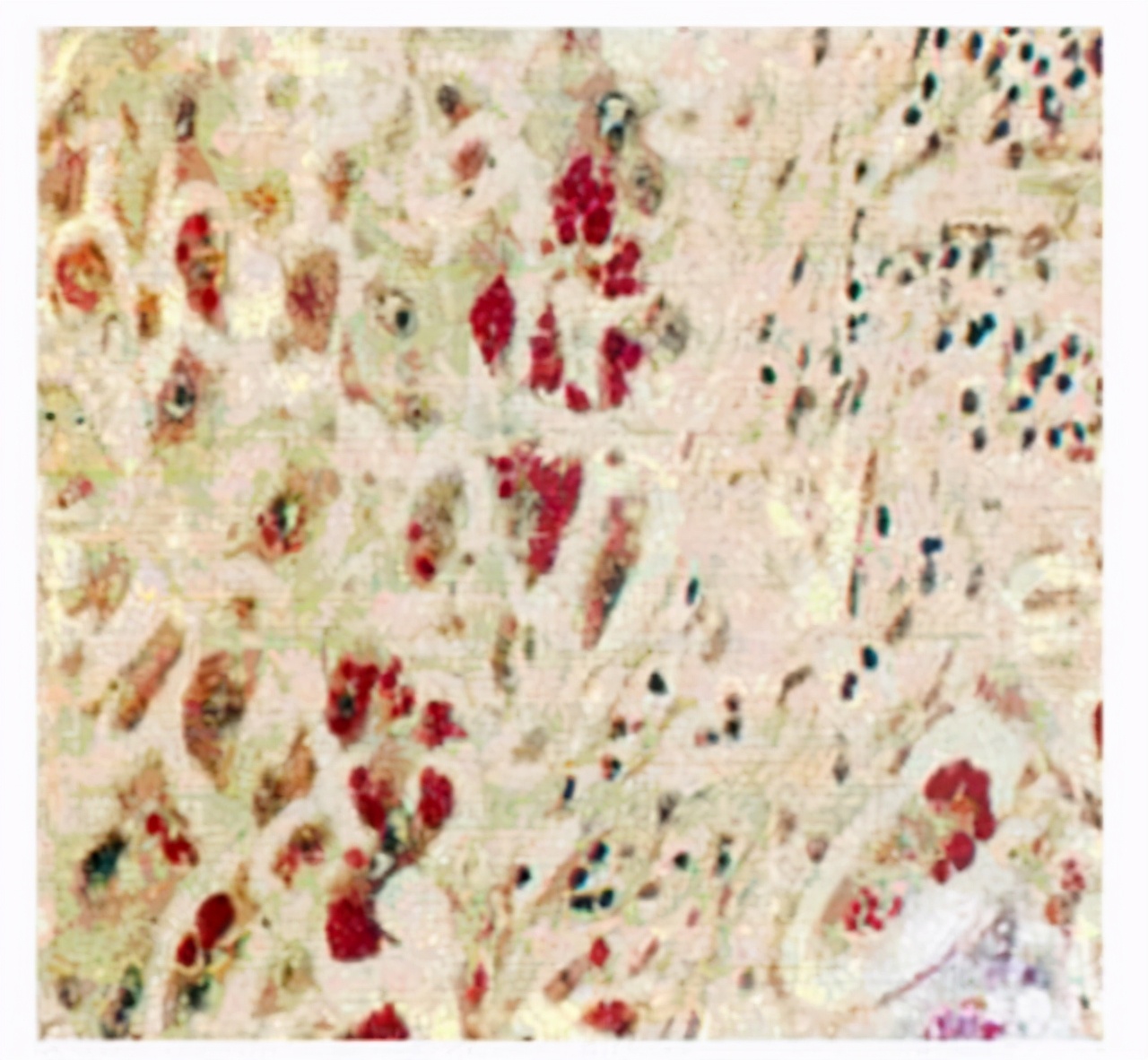 慢阻肺肺气肿的护理ppt,肺气肿不可逆怎么回事
