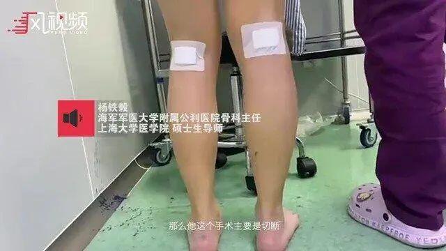 私密整容紧缩手术在中国合法吗,整容医院做私密收紧术要住院吗