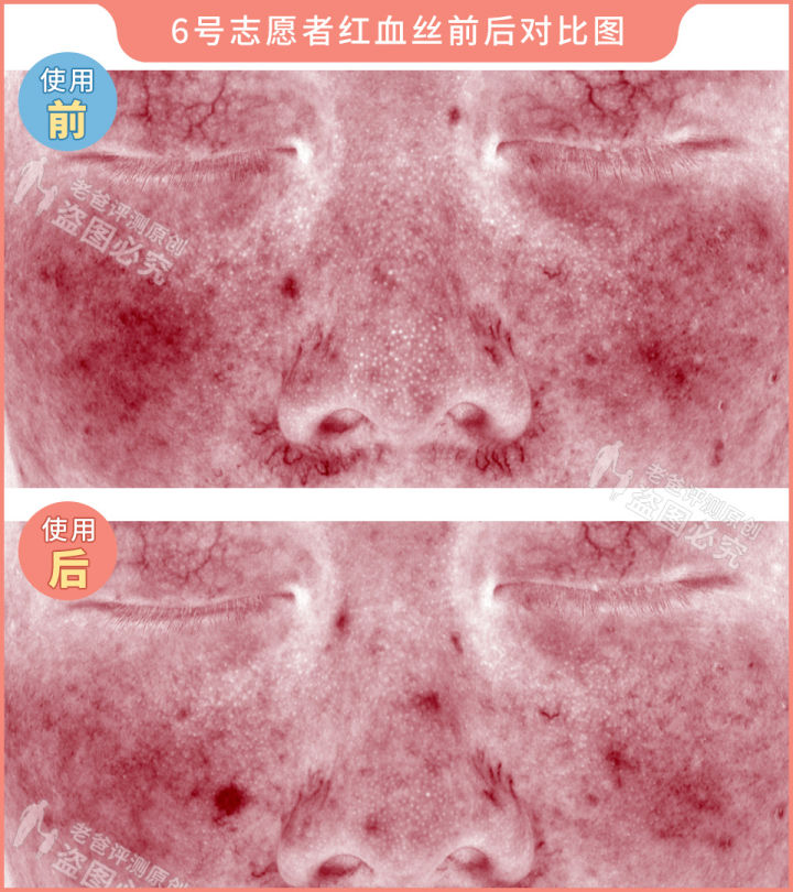 300块的网红美容仪有效果吗,网红家用美容仪测评