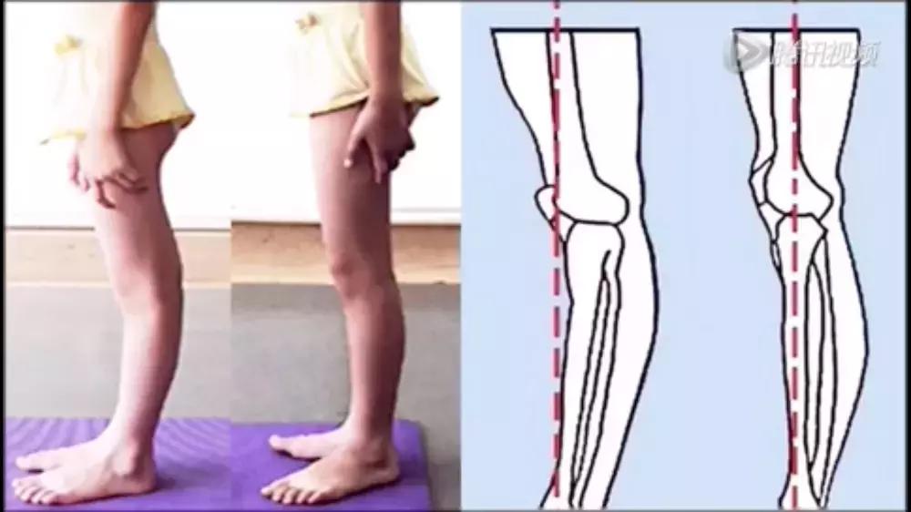 女生假胯宽怎么改善,如何解决女性假胯宽问题训练篇