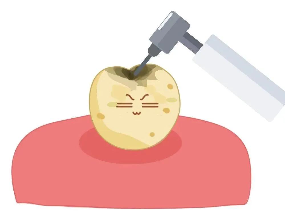 补一颗牙把好牙打磨了,上牙把下牙磨了一个坑