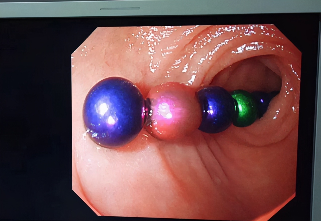 宝宝误食水晶泥多久可以确定没事 (宝宝误食了水晶泥后会有什么反应)